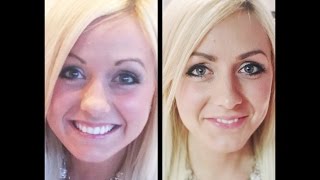 Carlys Brow Transformation