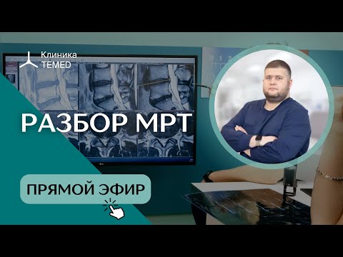 Разбор МРТ. Часть