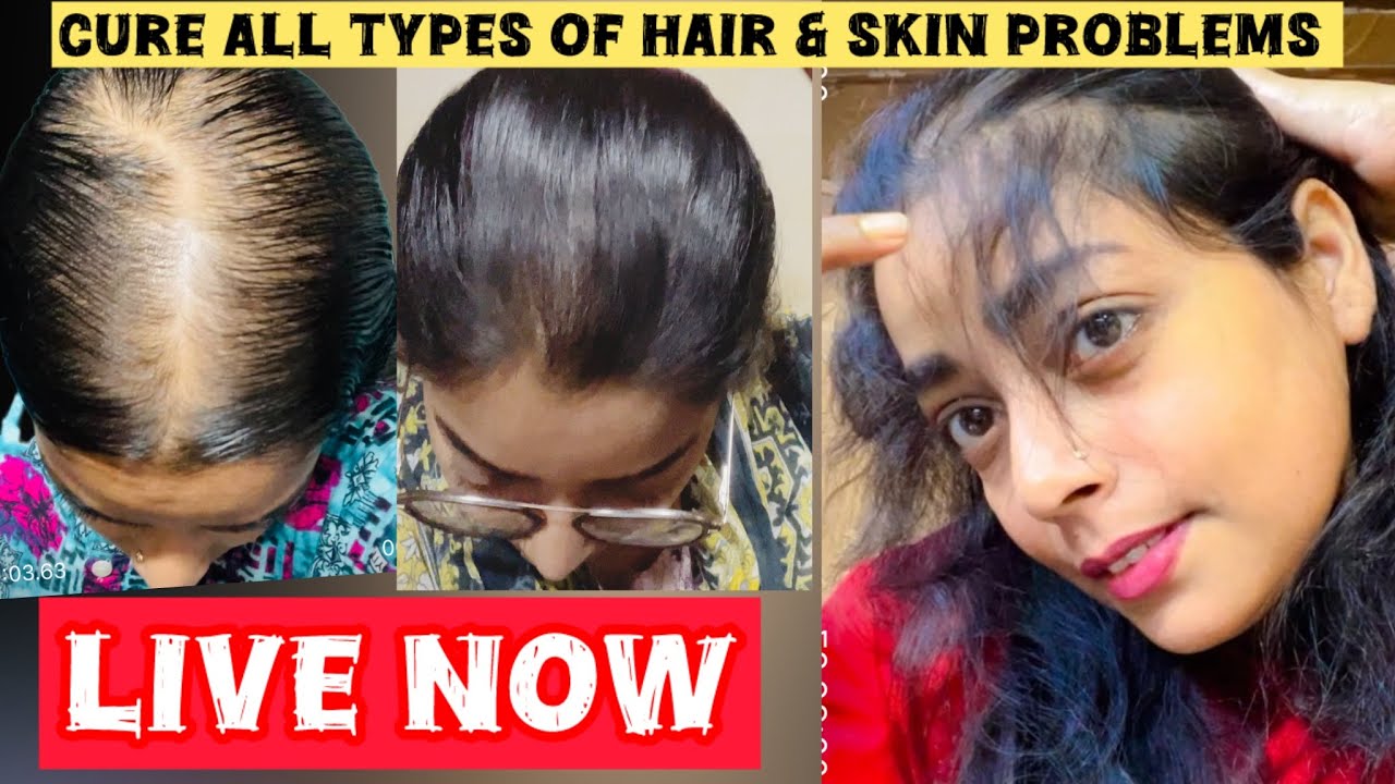 Live Now✨Cure All Types Of Hair & Skin Problems👍