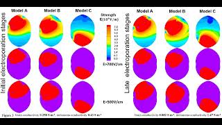 Electroporation-based biopsy simulations. QuickField webinar