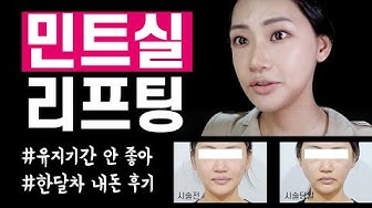 Thread Lift Review Mint Thread Lift는 40대를 위한 효과적이고 통증 없는 치료법입니다.수술 후 변화