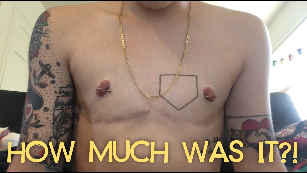 how-i-paid-for-my-top-surgery-youtube