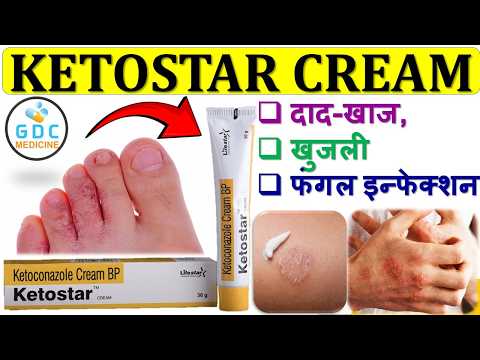 ketostar cream uses in hindi 😍📢✅फंगल इंफेक्शन Cream | ketostar cream kis kaam aata hai #fungalcream