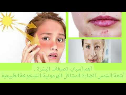     لاروش بوزيه يجمنتكلار كريم للتصبغات والبقع الداكنة  