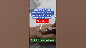 How to give IV injection, Injection in vein #drniteshraj #ytshorts #viral #injection #shorts #yts...