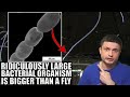 Incredibly Large 2cm Long Bacteria Breaks a Lot of Rules of Biology