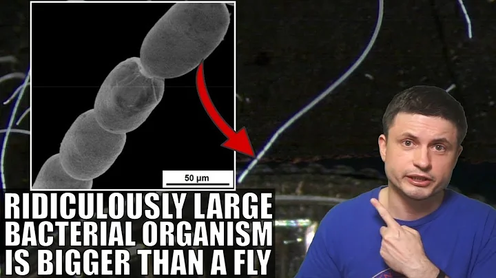 Incredibly Large 2cm Long Bacteria Breaks a Lot of Rules of Biology - DayDayNews