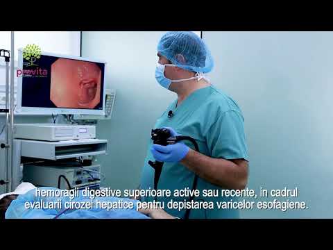Video: Pregătirea Pentru O Endoscopie