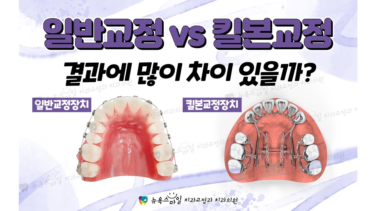 일반교정 vs 킬본교정 결과에 많이 차이 있을까? [부산,대구킬본교정 - 뉴욕스마일 치과교정과 치과의원]