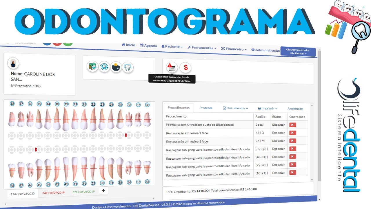 Odontograma Conheça um pouco mais Software Odontológico Life Dental YouTube