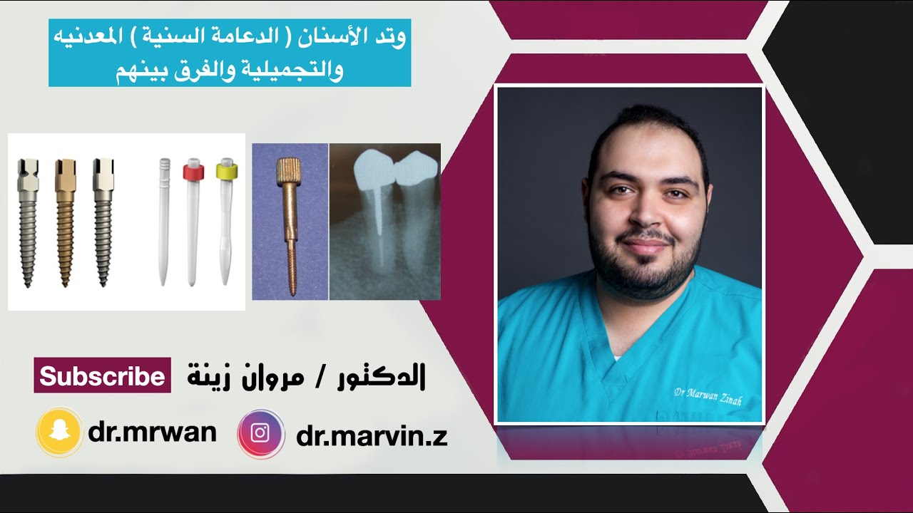 وتد الاسنان ( الدعامة ) تعريفه وانواعه واستعمالاته