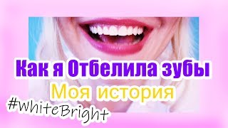 Как я отбелила зубы (#PQWhiteBright)