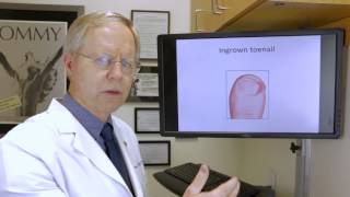 Encinitas Podiatry Group -  Ingrown Toenail