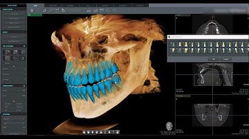 Ez3D-i 5.1 Teaser Video