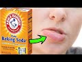 How To Get Rid Of A FAT | SWOLLEN LIPS Fast With Home Remedies