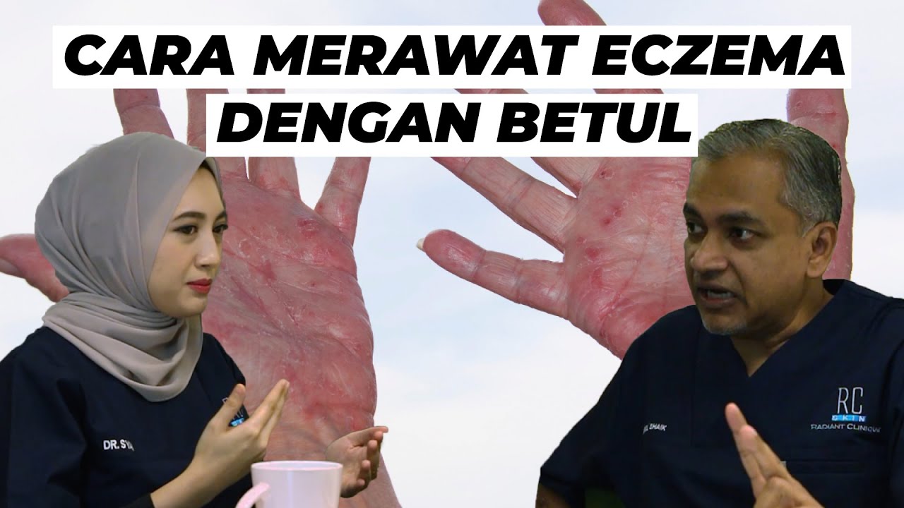 Cara-cara menangani Eczema dengan BETUL | Sembang Santai #2