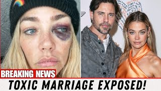Hollywood Scandal: Denise Richards Claims Aaron Phypers Abused Her