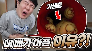 과민성 대장 증후군 이유가... 장 속에 기생충 때문이라고?!