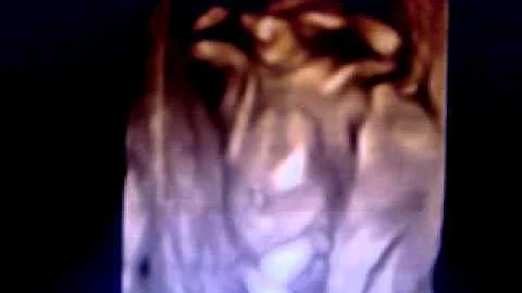 Baby DeHart