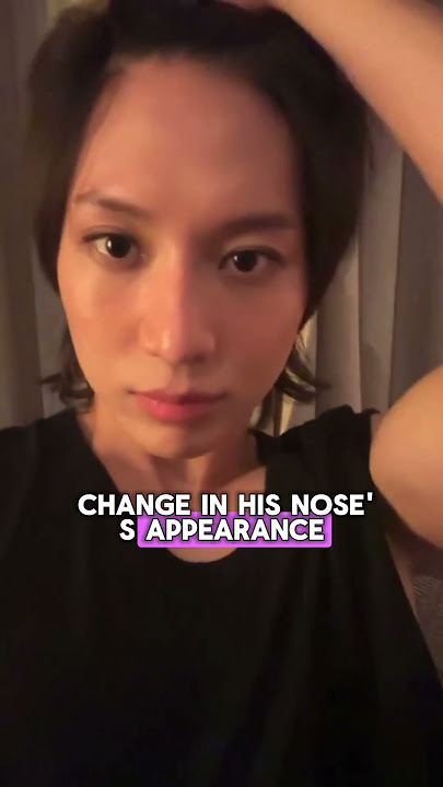 Taemin Face Become UGLY After Do A Plastic Surgery To His Nose! 😭😭 #taemin #shinee #kpop