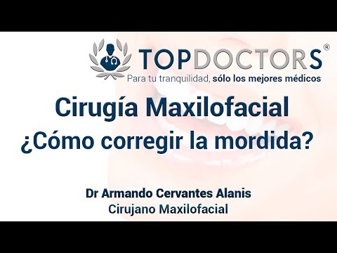 ¿Cómo corregir la mordida? Descubre la cirugía ortognática