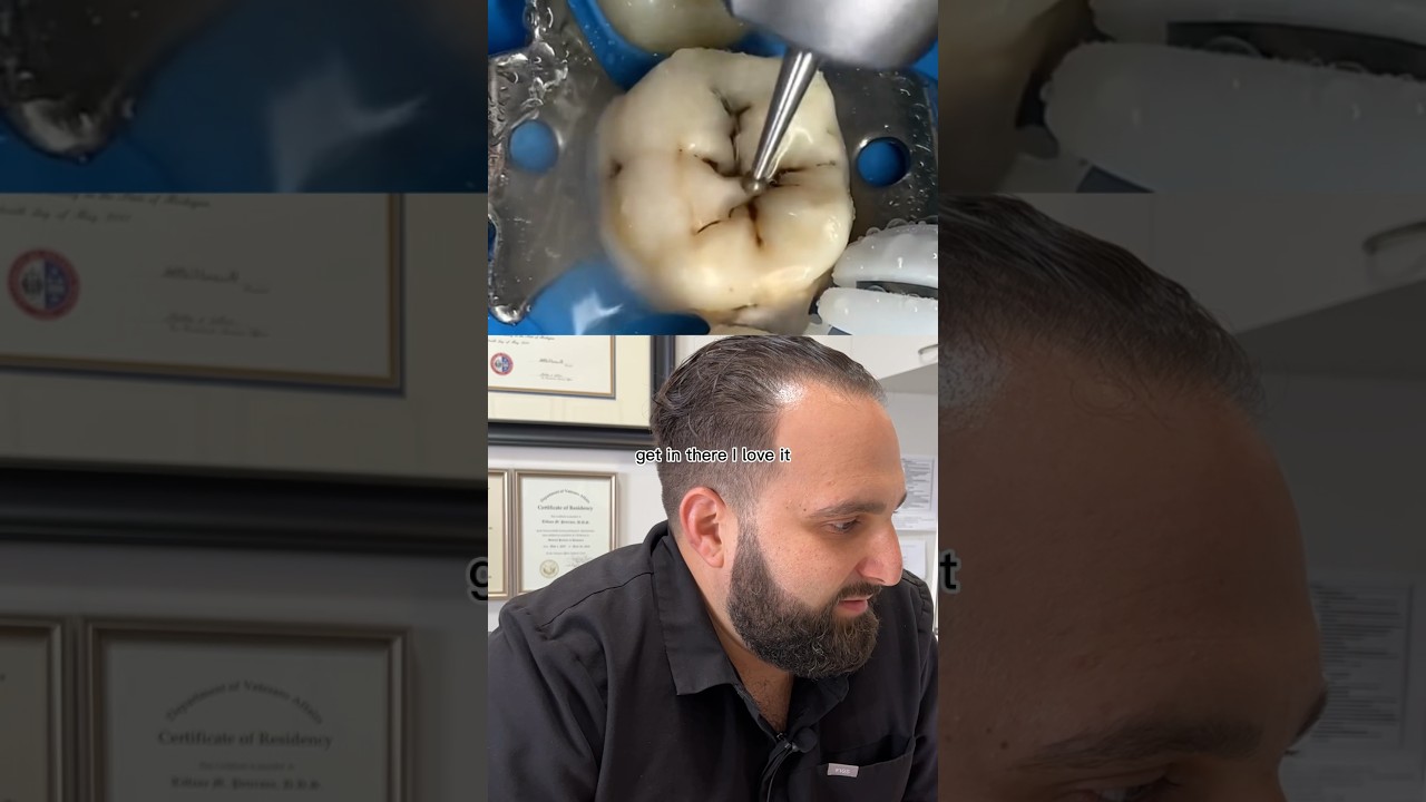 Would hate to have a cavity like THIS ONE⬆️⬆️👀 Better just to come in for your checkups😁❤️