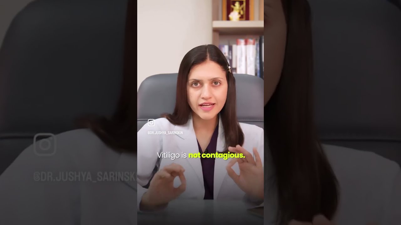  Facts About Vitiligo All Indians Must Know Dr Jushya Sarin
