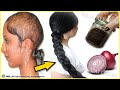 How to use onion for extreme hairfall / Hair loss / Best indian secret for hair growth