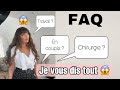 Faq chirurgie  en couple  travail  je vous dit tout 