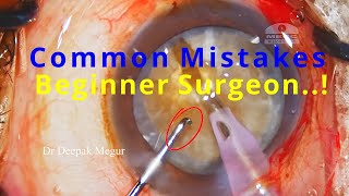 Common Mistakes of a beginner Phaco Surgeon during nucleus management- An analysis: Dr Deepak Megur