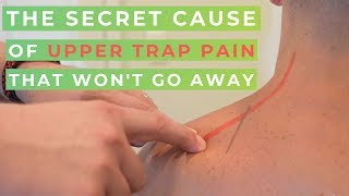 Upper Trap Pain? The SECRET Cause When You Can't Drop Your Shoulders screenshot 5
