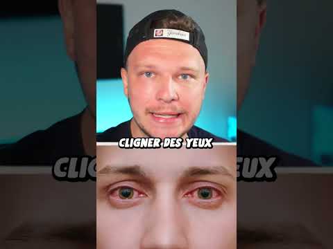 Vidéo: Pourquoi les vrais yeux croisés ?