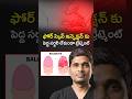 ఫోర్ స్కిన్ ఇన్ఫెక్షన్ కు Advanced Stapler Circumcision | Balanitis | Treatment Range | #shorts