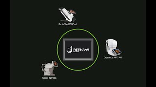 RETINA AI Galaxyu2122 Autonomous Artificial Intelligence (AI) Detection of Diabetic Retinopathy