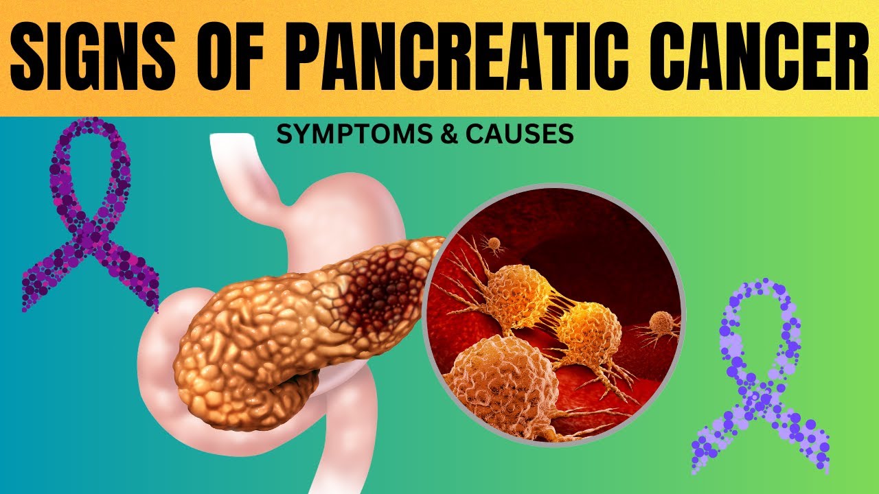 Pancreatic Cancer: Causes & Symptoms You Need to Know - YouTube