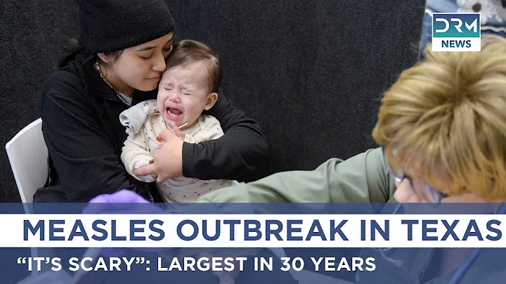 CDC Sounds Alarm: Texas Measles Outbreak Worsens Amid Budget Cuts | DRM News | AR1B