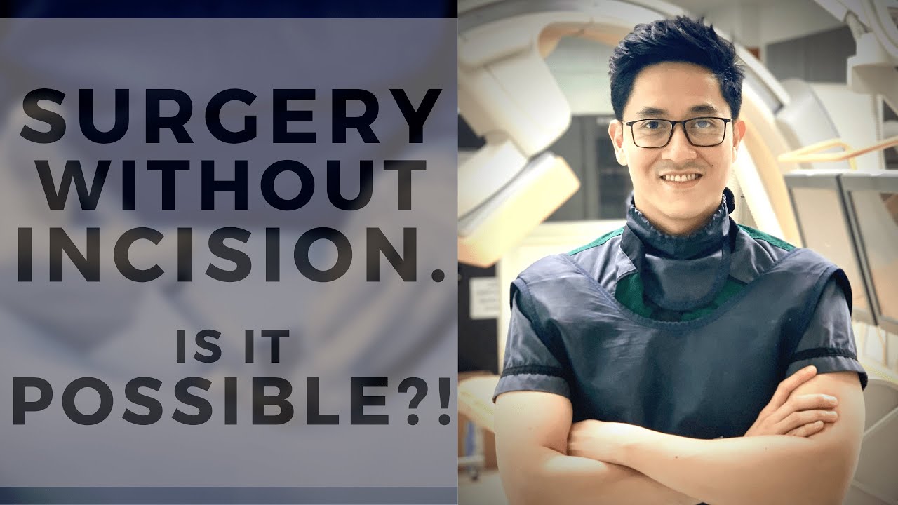 DOCTORS PERFORM SURGERY WITHOUT USING A KNIFE!! YouTube
