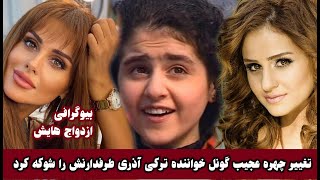 تغییر چهره عجیب گونل طرفدارانش را شوک زده کرده Günel Zeynalova