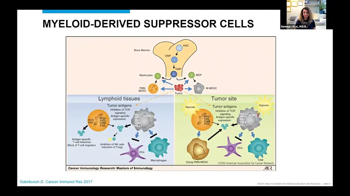ICRN Webinar: Targeting Immunosuppressive Myeloid Cells in Cholangiocarcinoma
