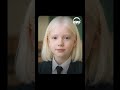 Real Facts About Early White Hair!!!! #podcast #viral #viralshorts #shorts  #shortvideos #reels