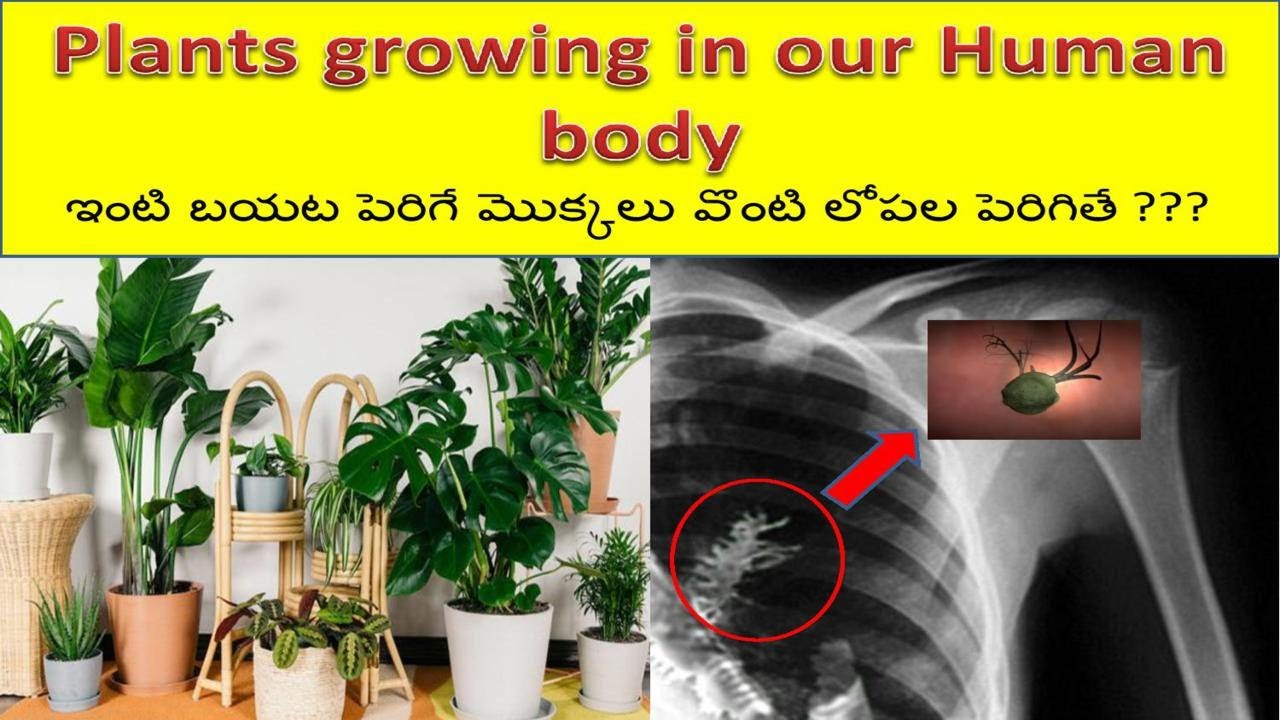 Can Plants Grow in a Body  