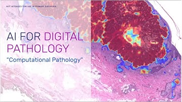 Why AI will dramatically increase accuracy in Pathology