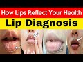 5 Things Your Lips Will Tell You About Your Health