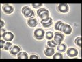 Blood microscopyphase contrast some rouleaux