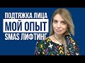 ПОДТЯЖКА ЛИЦА: правда о SMAS лифтинге (2020)