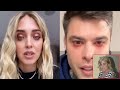 Fedez e chiara ferragni il vero motivo della rottura lui ha una nuova casa