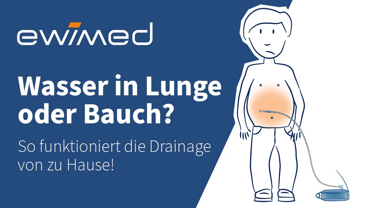 Wie Lange Kann Eine Drainage Drin Bleiben Wasser in der Lunge oder Bauch? - So funktioniert die Drainage von zu
