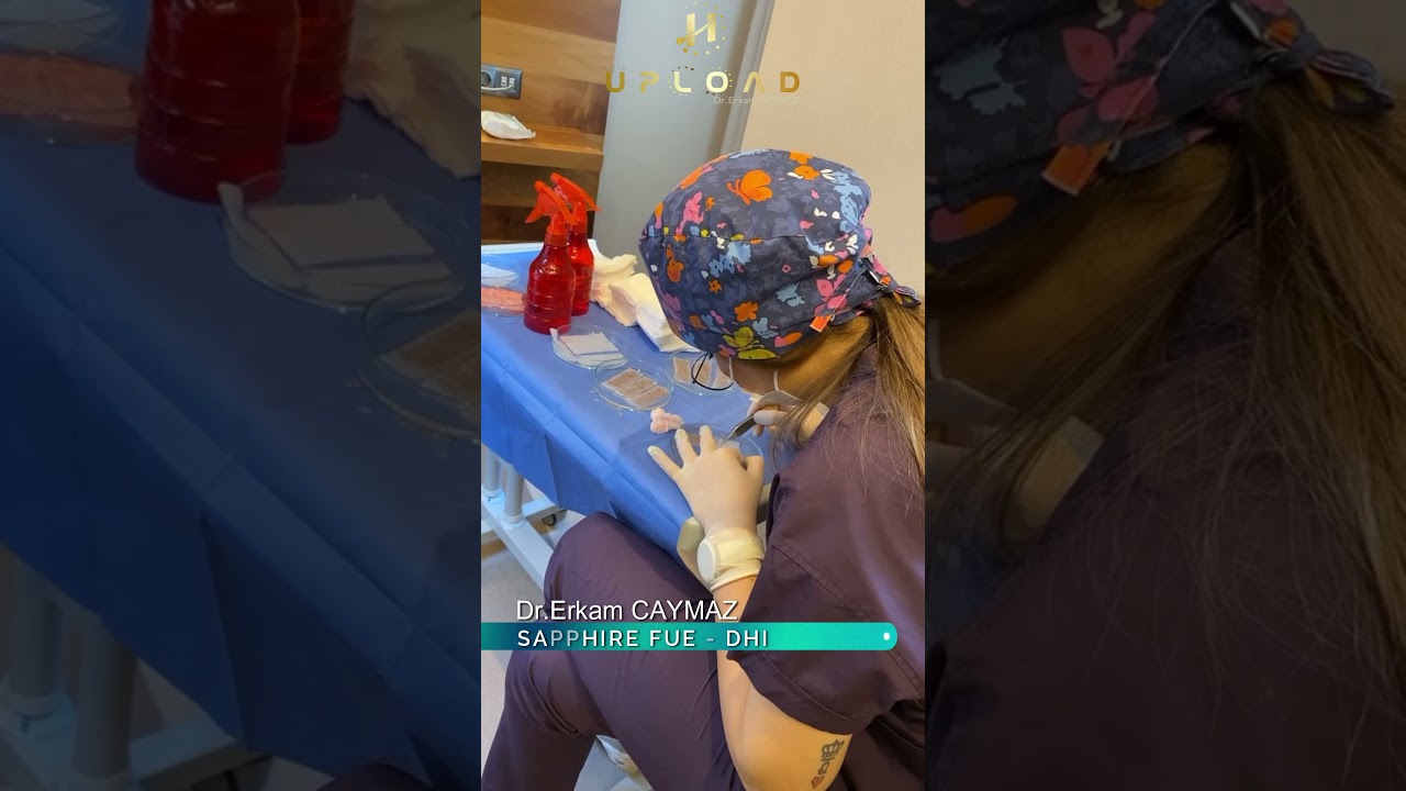 Hair Transplant in Turkey Istanbul - Dr Erkam CAYMAZ