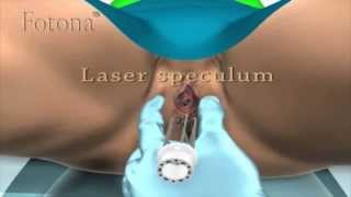 Download Lazer İle İdrar KaÇirma Tedavİsİ Video MP3 Lazer İle İdrar KaÇirma Tedavİsİ