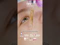 Protocolo post-peeling clínico: cuidados esenciales para profesionales - TECH Universidad